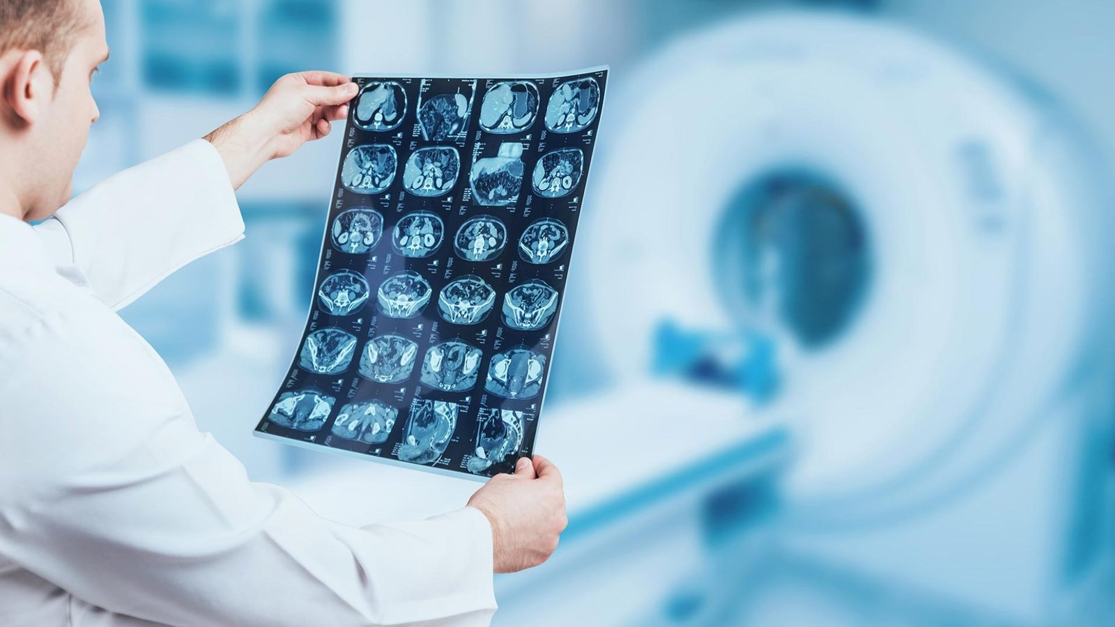  A man in a white coat holds an MRI scan, examining the image with a focused expression in a clinical setting.