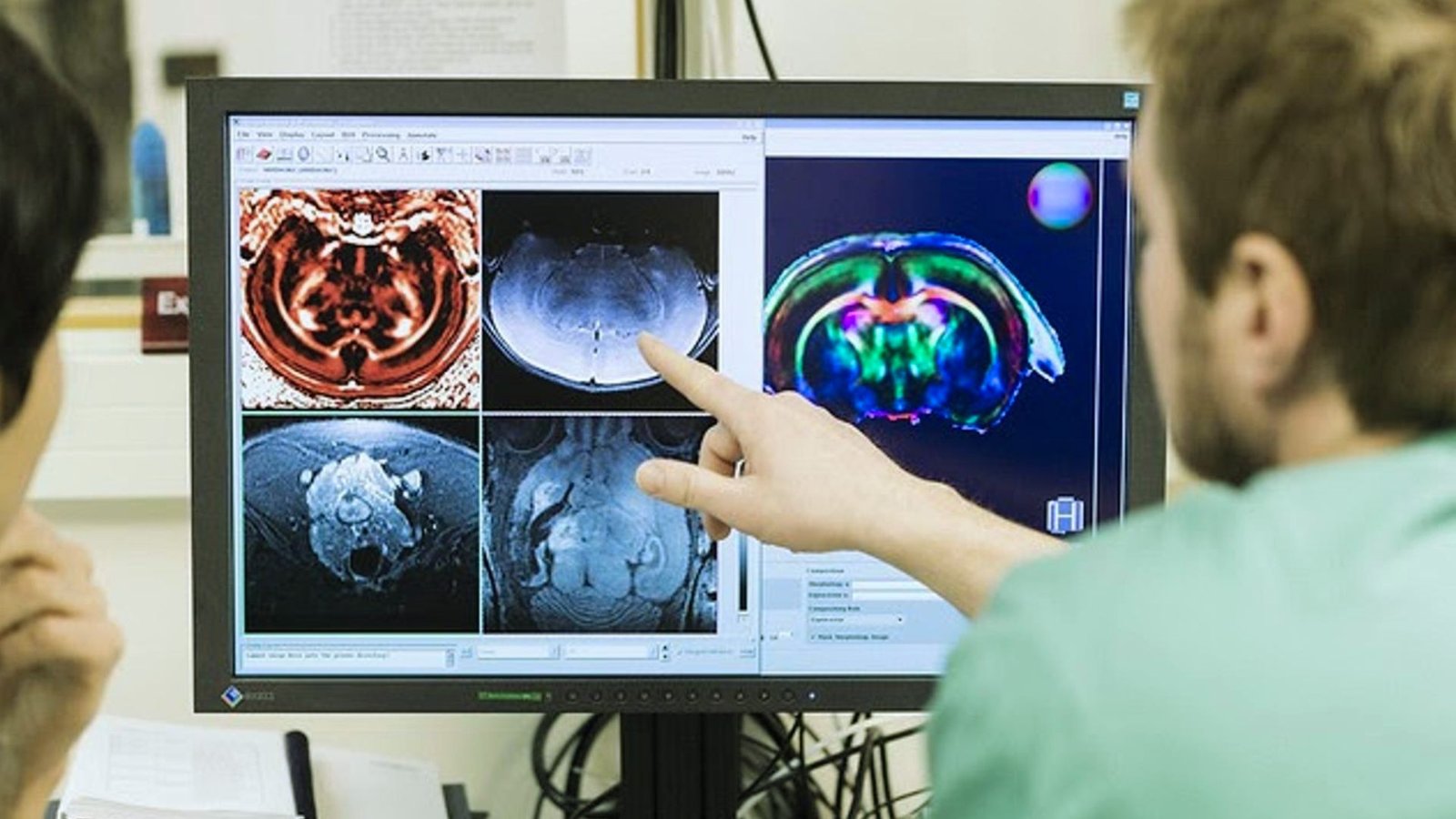  Two men examining a computer screen displaying a brain scan, engaged in discussion about the findings.