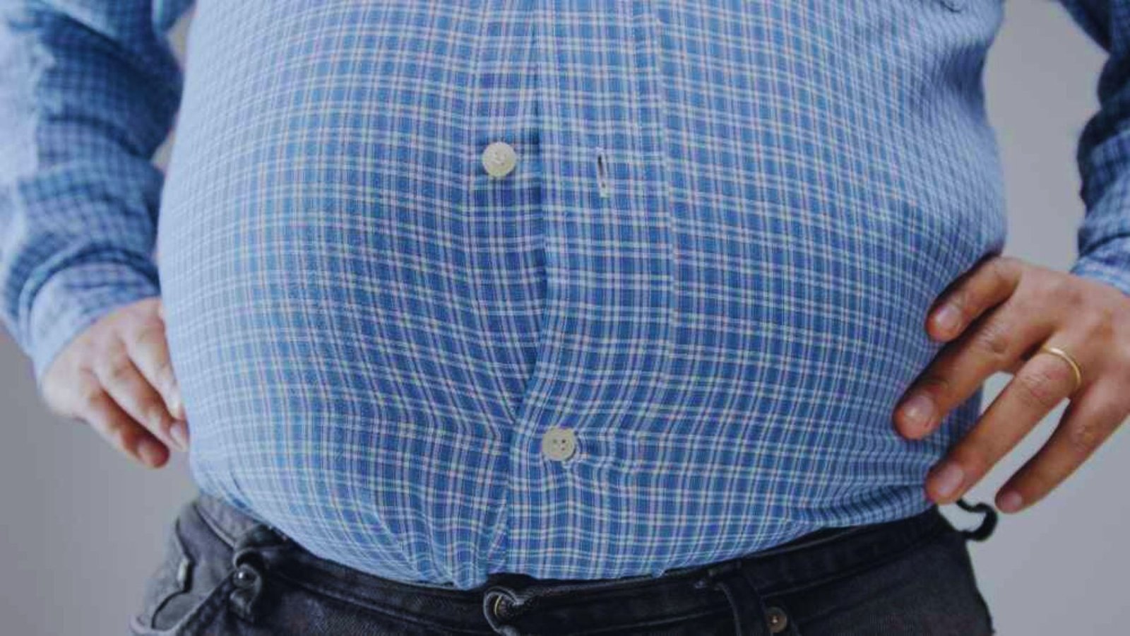 What Is Android Obesity?
